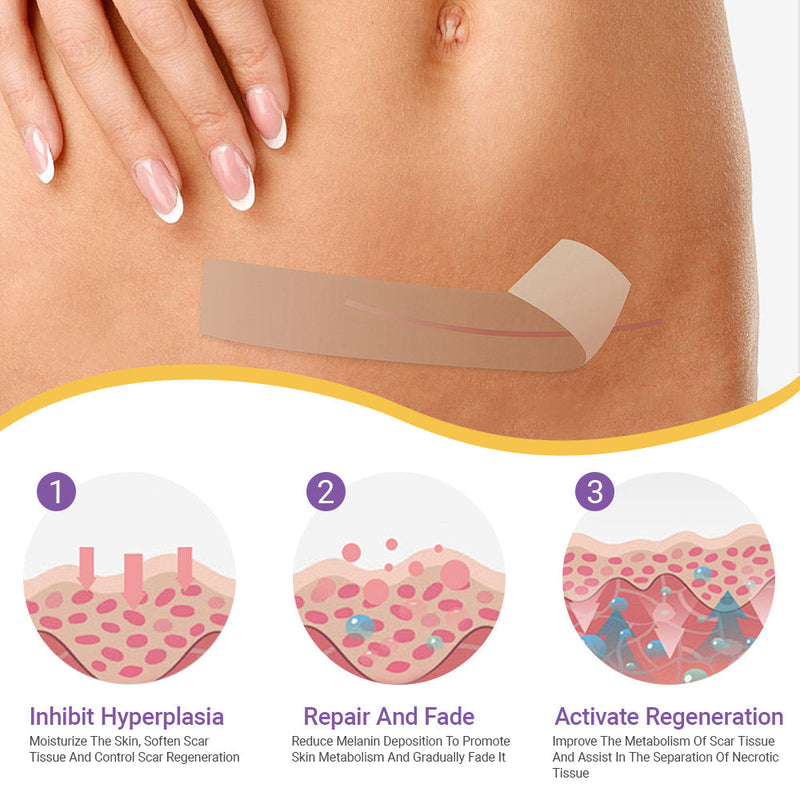 ✅Official Store |BBOJI® Hyaluronic Acid Nano Microneedle Repair Tape🏥(Treatment of old and new scars, reduction of surgical scars, stretch marks, keloids, acne, burns, warts, dermatomes and varicose veins)