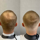 Preenchedor de Fibra Capilar – Cobre Falhas com Volume Natural