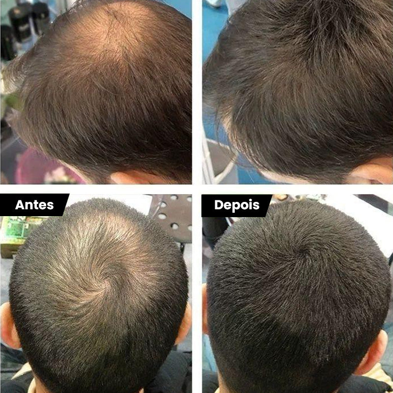 Preenchedor de Fibra Capilar – Cobre Falhas com Volume Natural