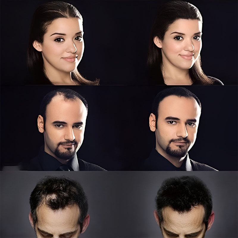 Preenchedor de Fibra Capilar – Cobre Falhas com Volume Natural